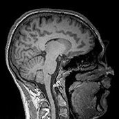structural MRI image of my brain